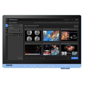 Advantech iVideOR iVideOR is a future-proof platform to transform surgical imaging workflows.